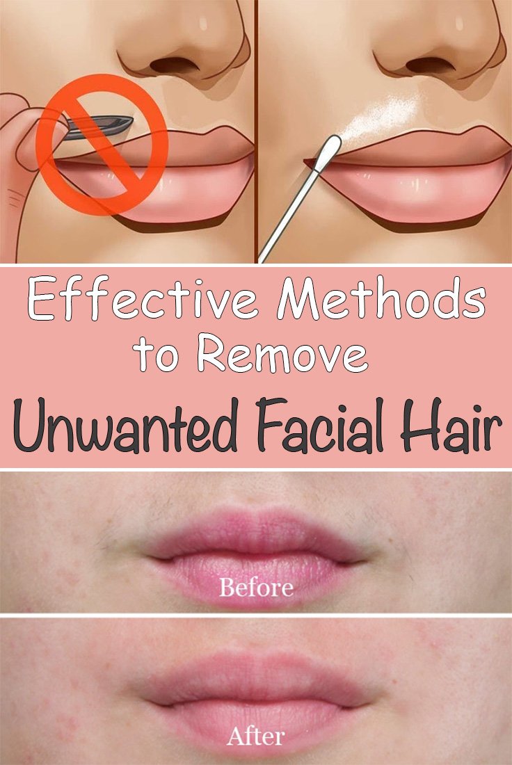 Effective Methods to Remove Unwanted Facial Hair iwomenhacks