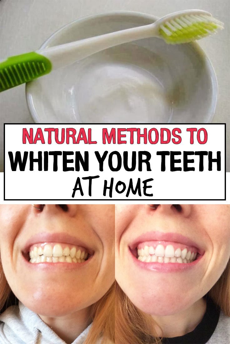 Natural Methods to Whiten Your Teeth at Home