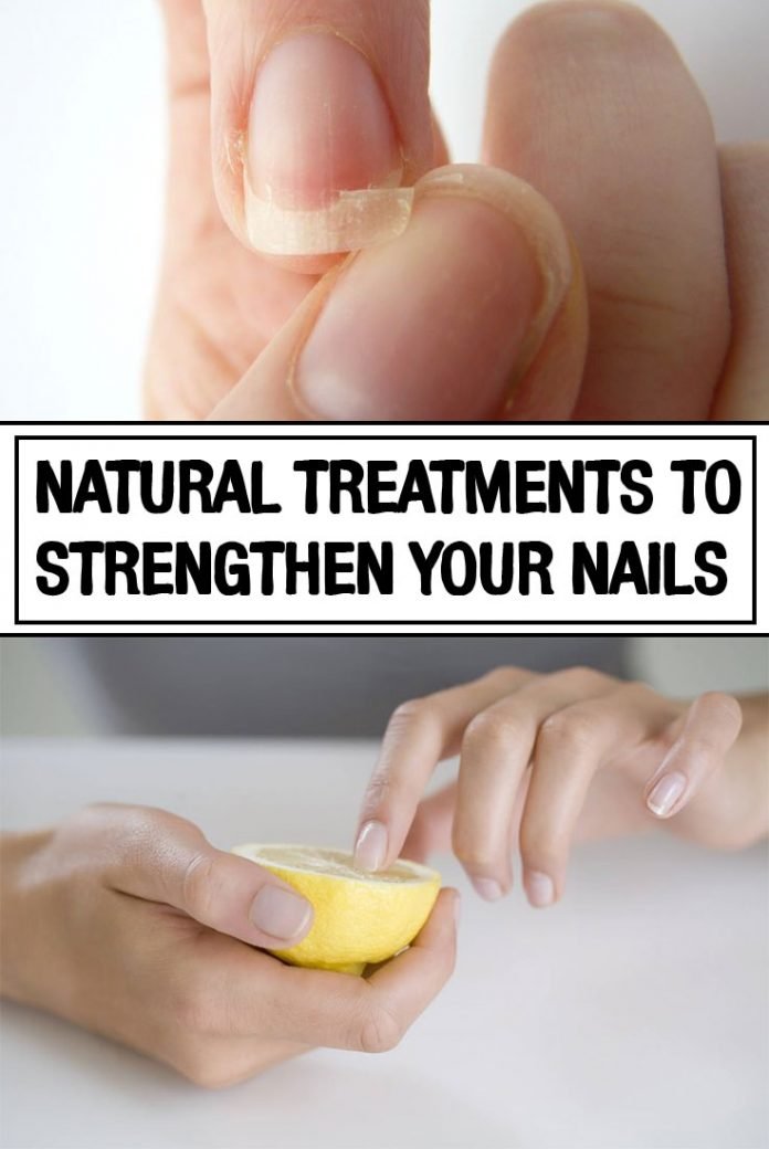 Natural Treatments To Strengthen Your Nails Iwomenhacks