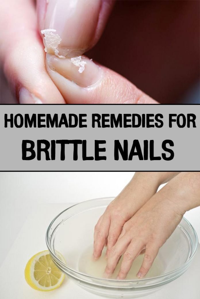 Homemade Remedies for Brittle Nails - iwomenhacks